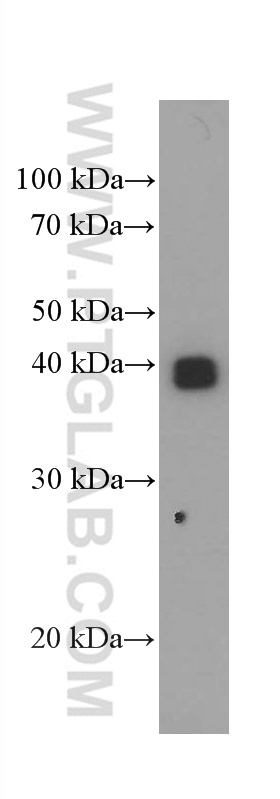 WB analysis of human placenta using 66447-1-Ig (same clone as 66447-1-PBS)
