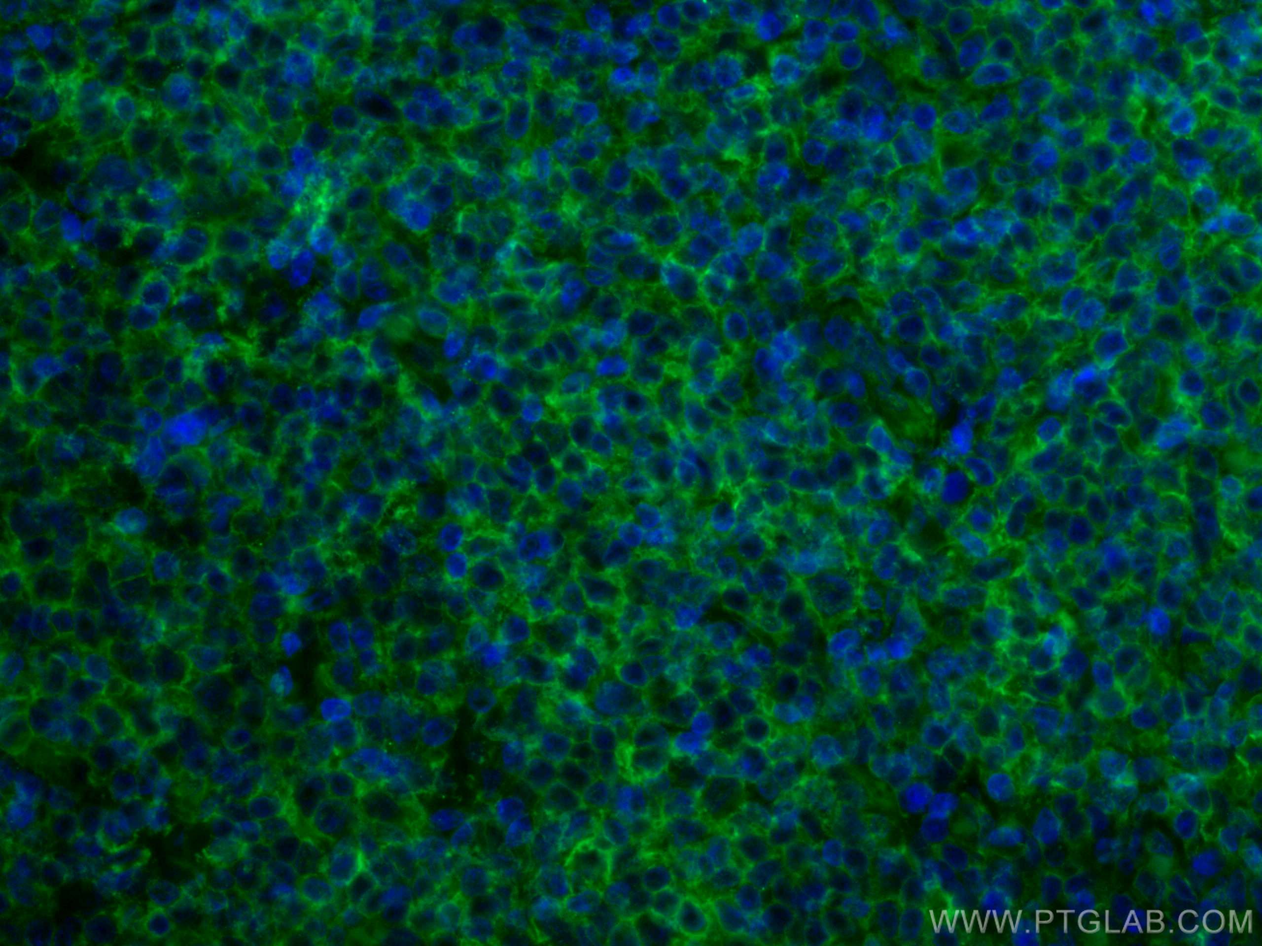 IF Staining of human tonsillitis using CL488-66013