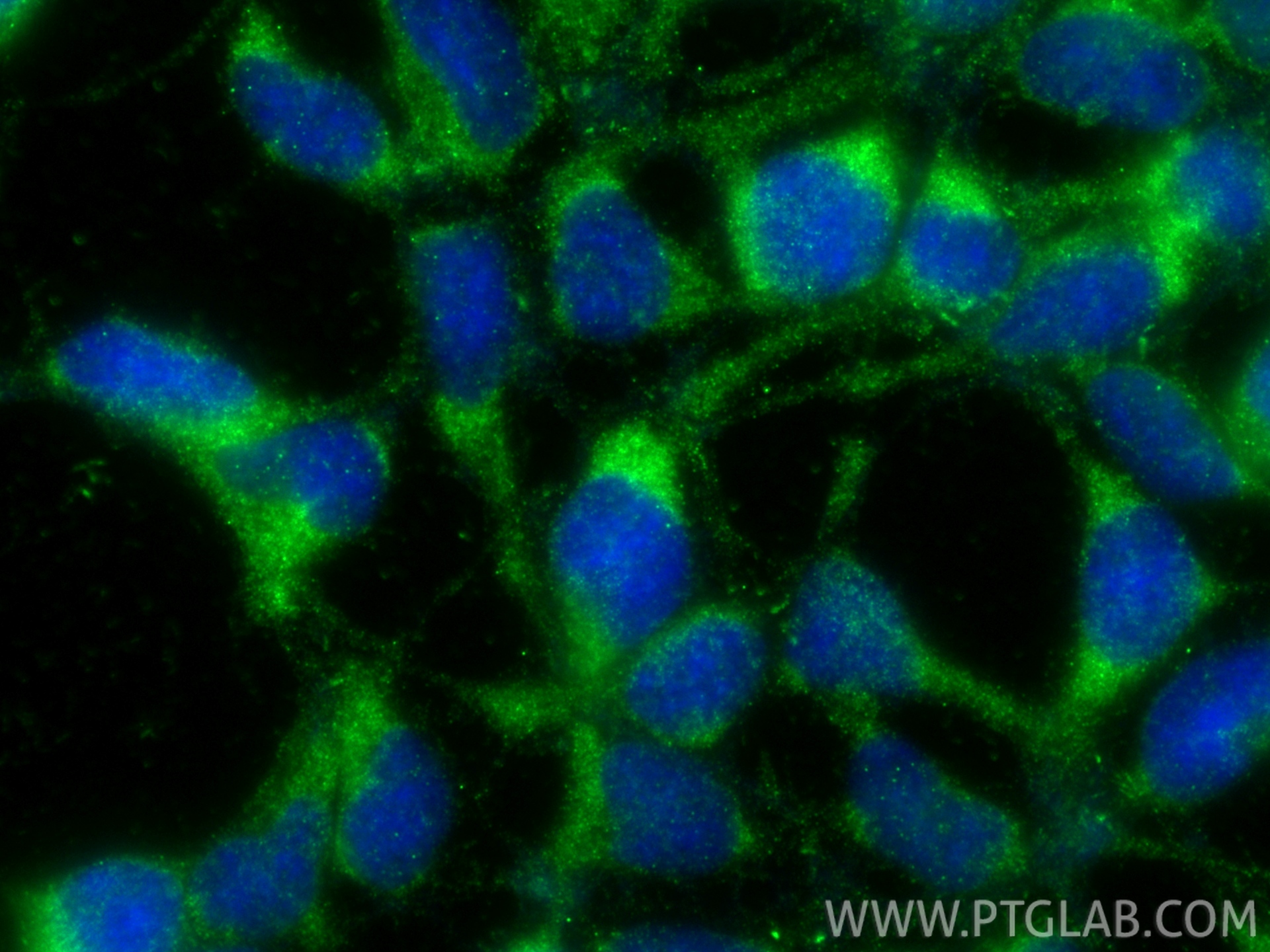 Immunofluorescent analysis of (-20°C Ethanol) fixed HEK-293 cells using HLCS antibody (14046-1-AP) at dilution of 1:400 and CoraLite®488-Conjugated Goat Anti-Rabbit IgG(H+L) (<a class='green' href='/productredirect?CatalogNo=SA00013-2' target='_blank'>SA00013-2</a>). IF Staining of HEK-293 using 14046-1-AP