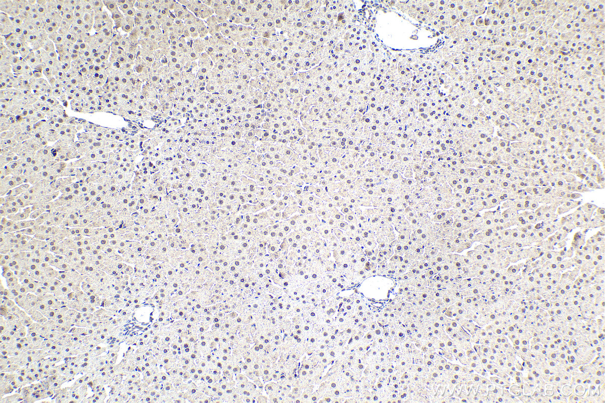 IHC staining of rat liver using 12870-1-AP