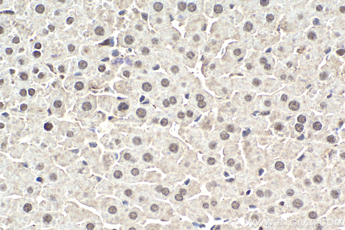 IHC staining of rat liver using 12870-1-AP