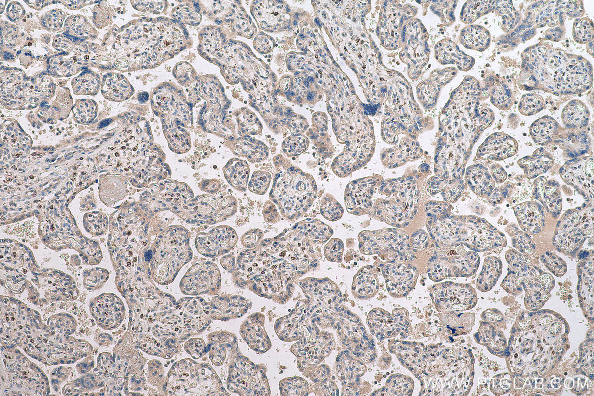 Immunohistochemical analysis of paraffin-embedded human placenta tissue slide using 14286-1-AP (HLTF antibody) at dilution of 1:500 (under 10x lens). Heat mediated antigen retrieval with Tris-EDTA buffer (pH 9.0). IHC staining of human placenta using 14286-1-AP