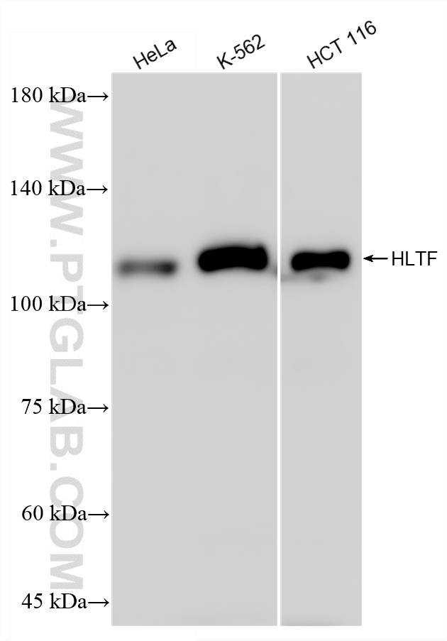 WB analysis using 86362-2-RR