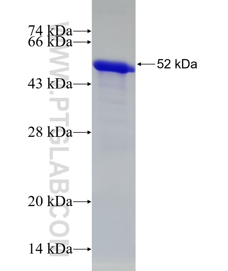 HMBOX1 fusion protein Ag9394 SDS-PAGE