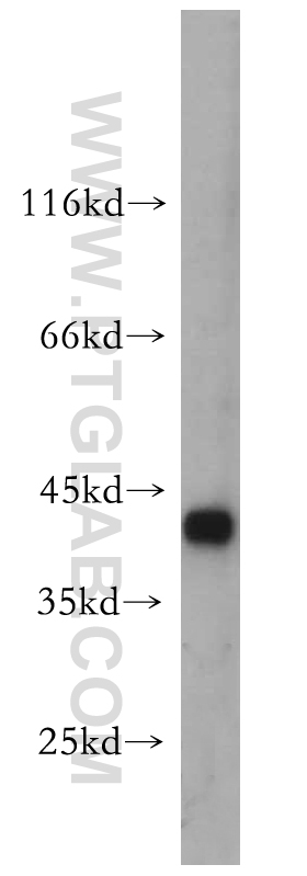 WB analysis of HeLa using 14797-1-AP