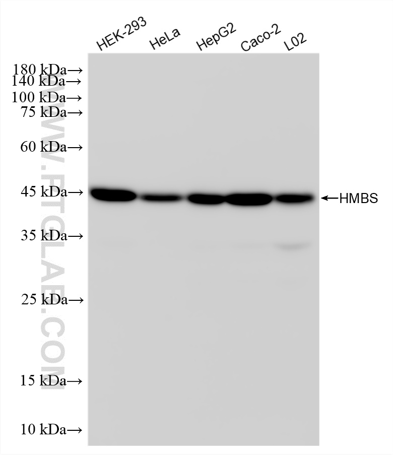 WB analysis using 87431-1-RR (same clone as 87431-1-PBS)