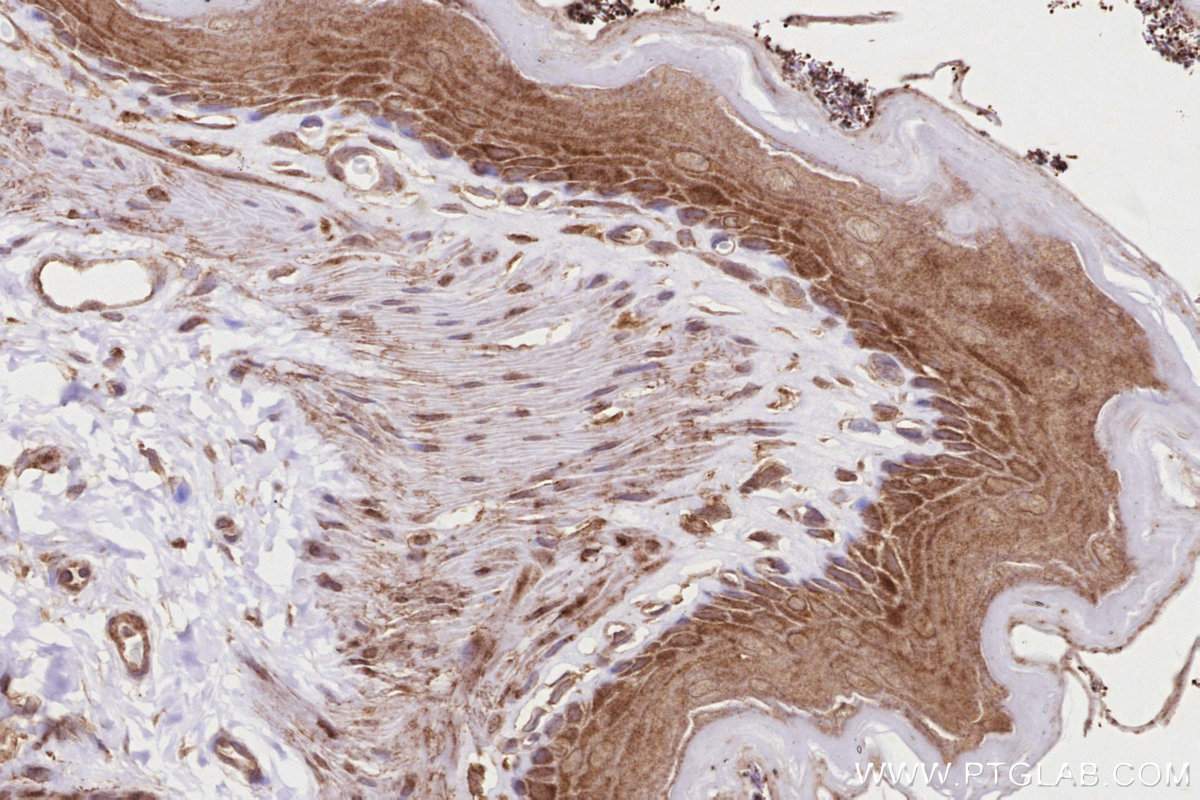 IHC staining of rat stomach using 18837-1-AP IHC staining of rat stomach using 18837-1-AP