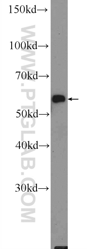 WB analysis of mouse skin using 18837-1-AP