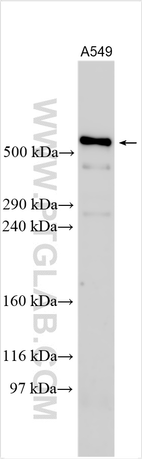 WB analysis using 32178-1-AP (same clone as 32178-1-PBS) WB analysis using 32178-1-AP (same clone as 32178-1-PBS)