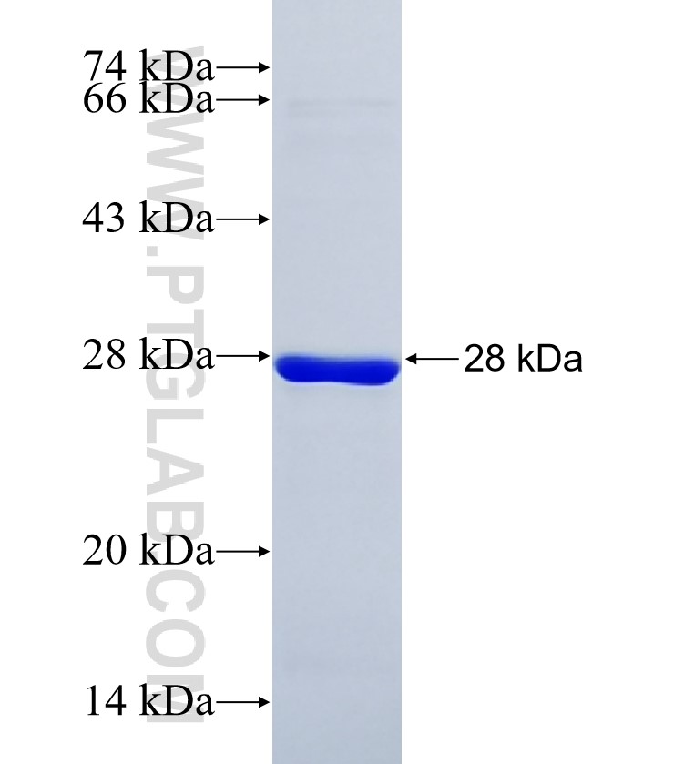 HMCN2 fusion protein Ag37624 SDS-PAGE