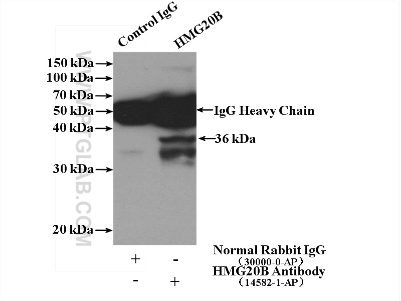 IP experiment of HeLa using 14582-1-AP