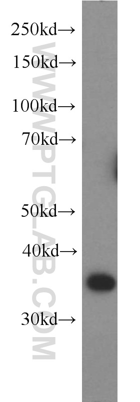 WB analysis of HeLa using 14582-1-AP