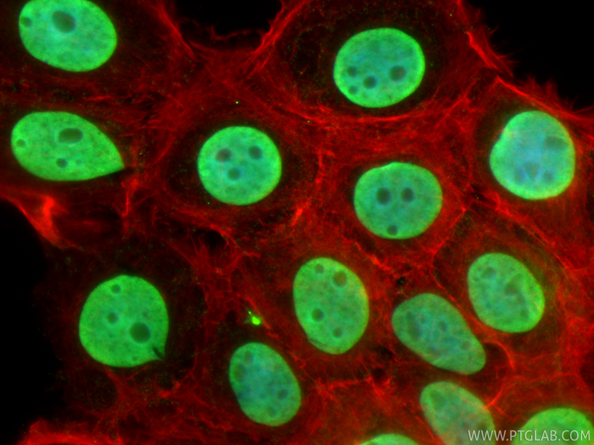 IF Staining of A431 using 29895-1-AP IF Staining of A431 using 29895-1-AP