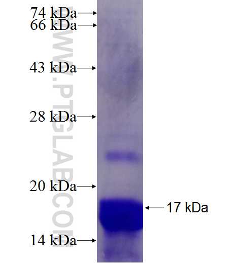 HMGA1 fusion protein Ag7637 SDS-PAGE HMGA1 fusion protein Ag7637 SDS-PAGE