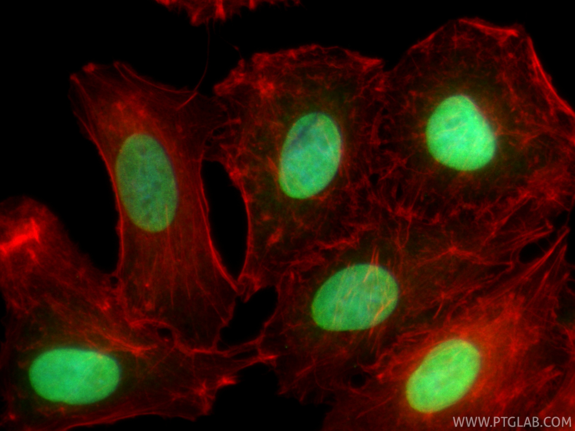 IF Staining of A549 using 20795-1-AP IF Staining of A549 using 20795-1-AP