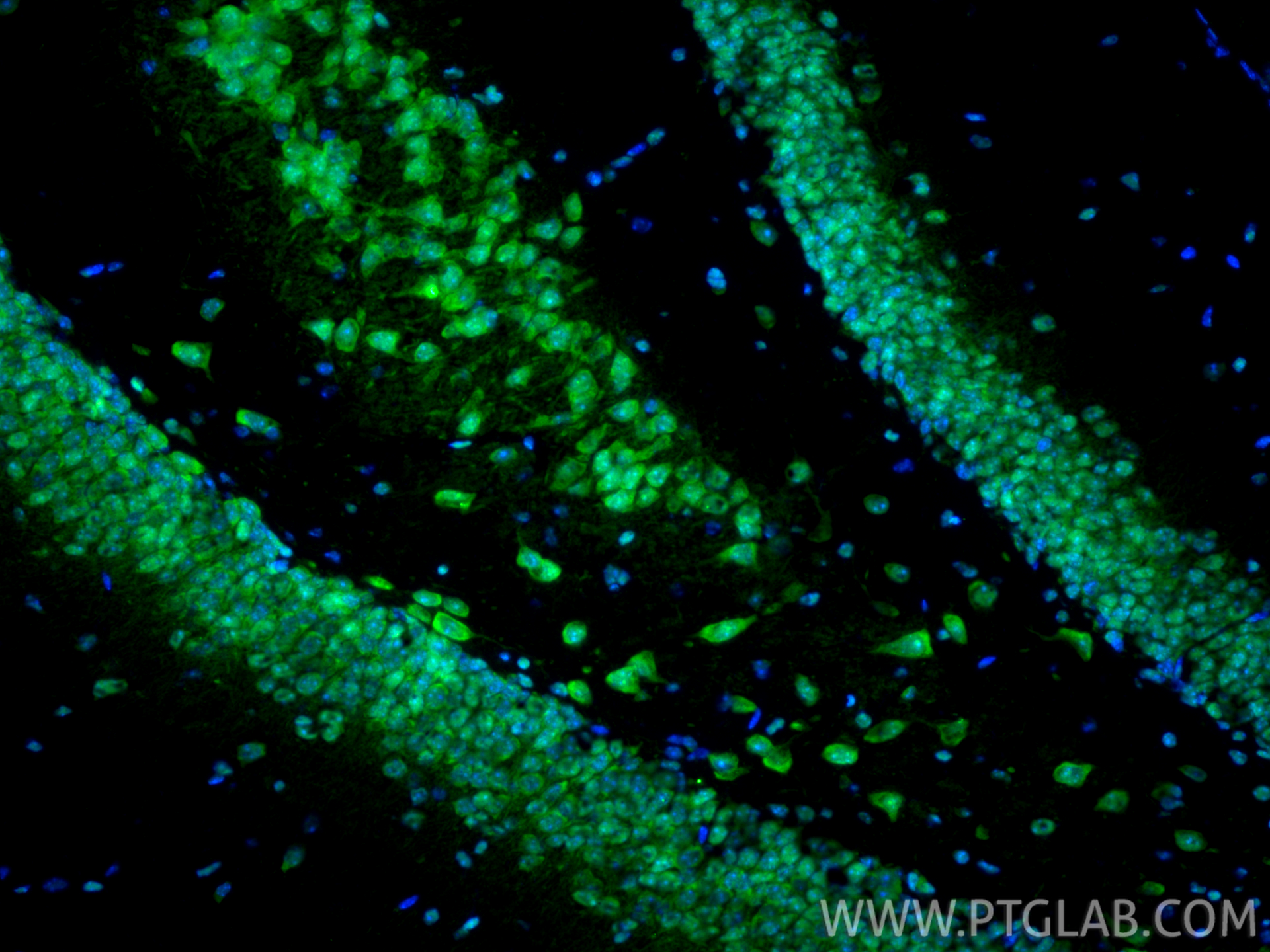 IF Staining of mouse brain using 10829-1-AP IF Staining of mouse brain using 10829-1-AP