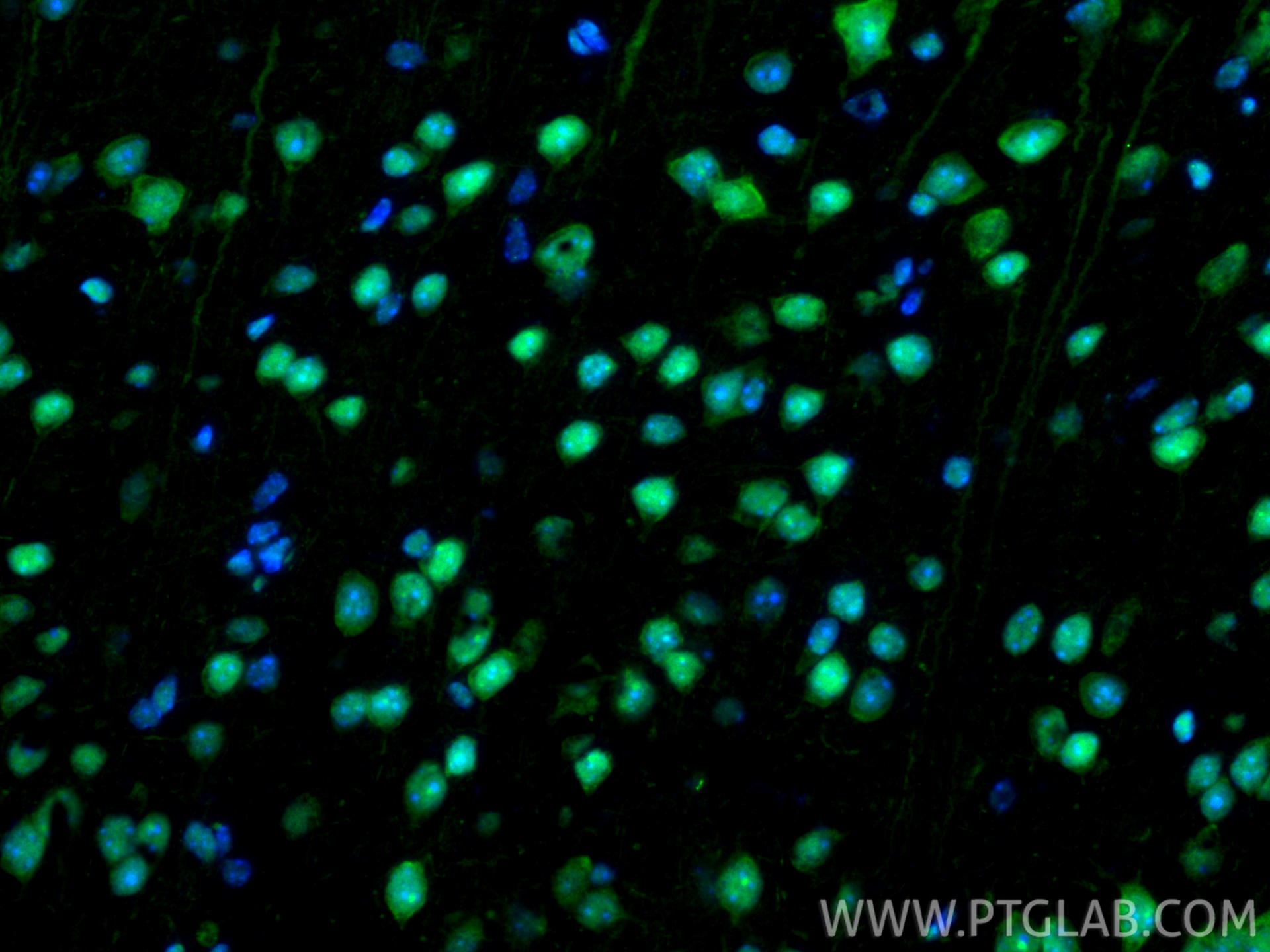 IF Staining of mouse brain using 10829-1-AP IF Staining of mouse brain using 10829-1-AP