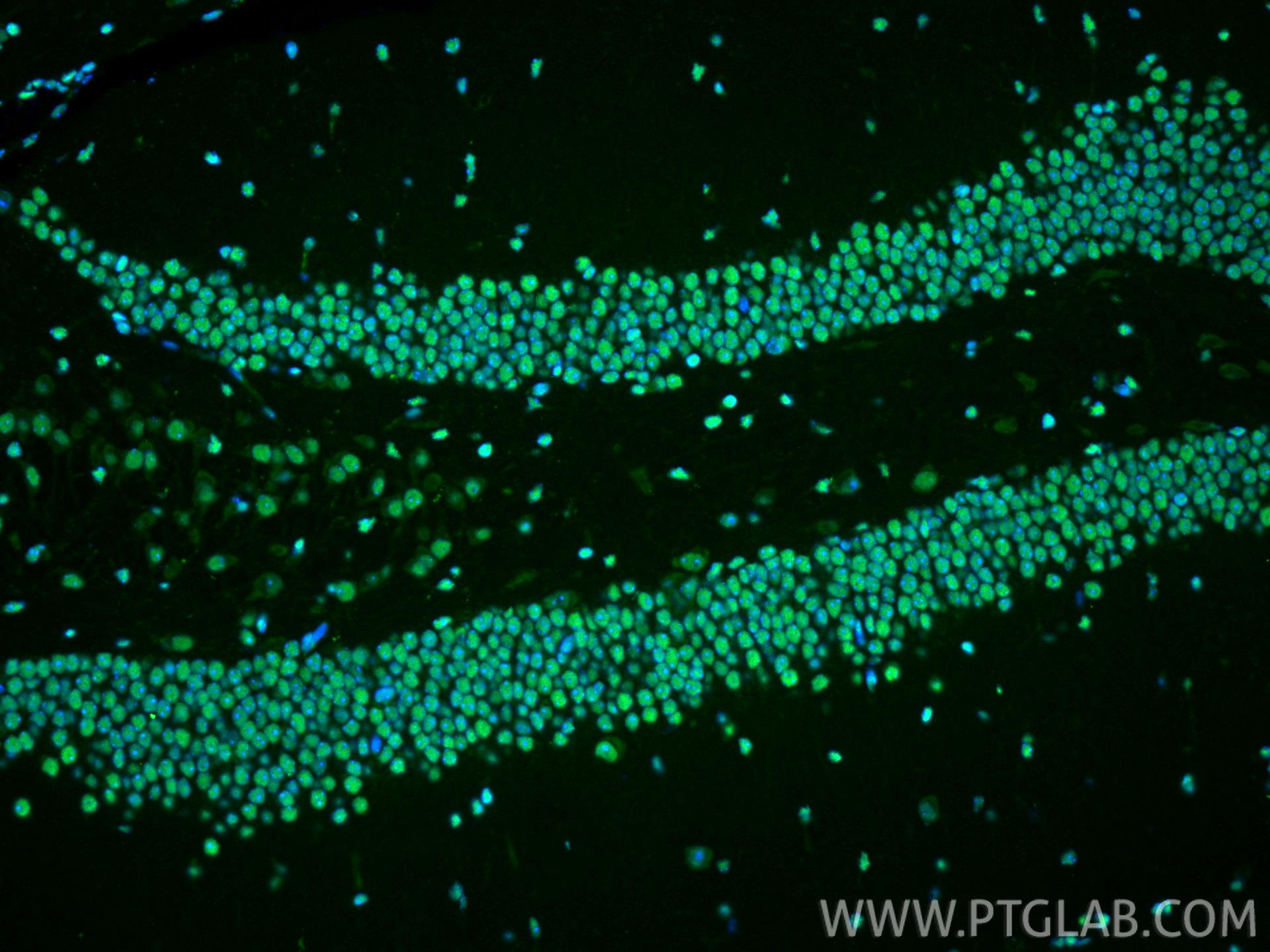IF Staining of mouse brain using 10829-1-AP IF Staining of mouse brain using 10829-1-AP