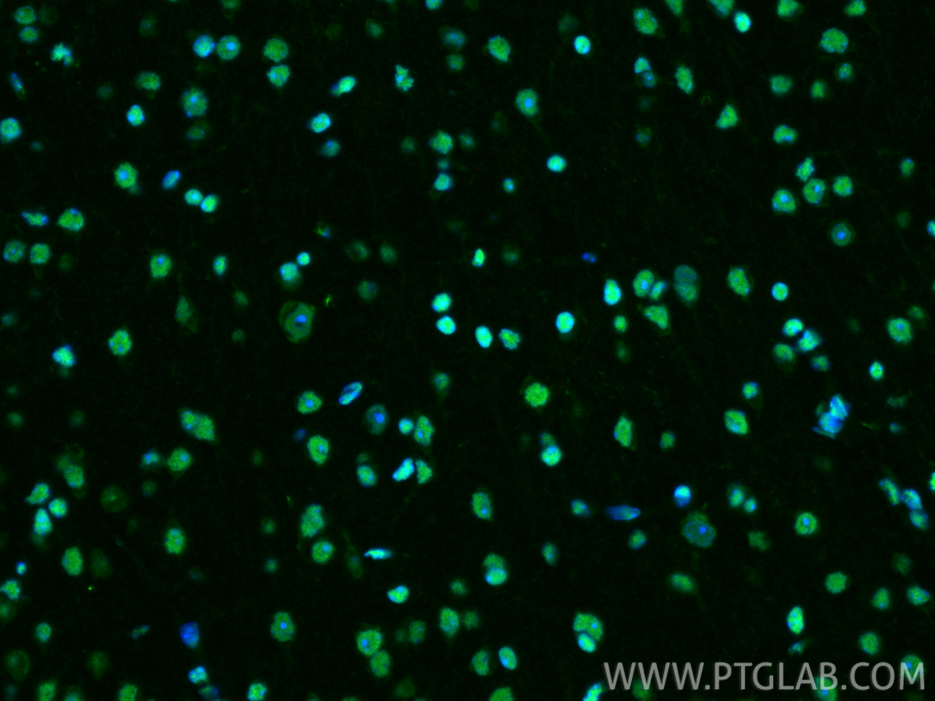IF Staining of mouse brain using 10829-1-AP IF Staining of mouse brain using 10829-1-AP
