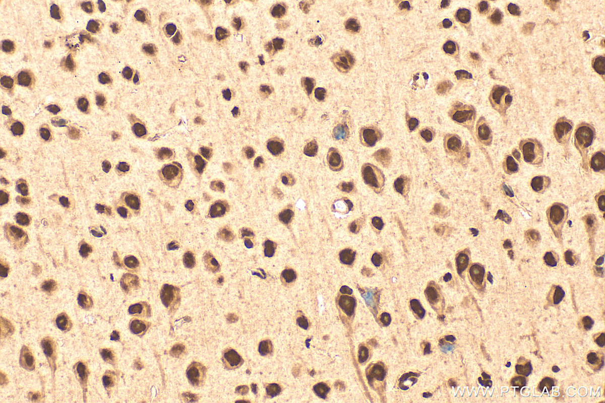 IHC staining of mouse brain using 10829-1-AP