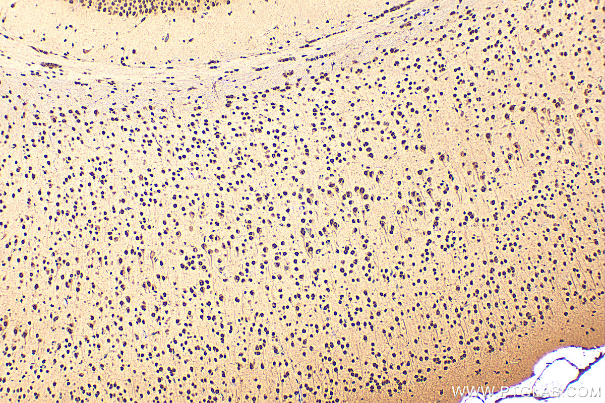 IHC staining of mouse brain using 10829-1-AP IHC staining of mouse brain using 10829-1-AP