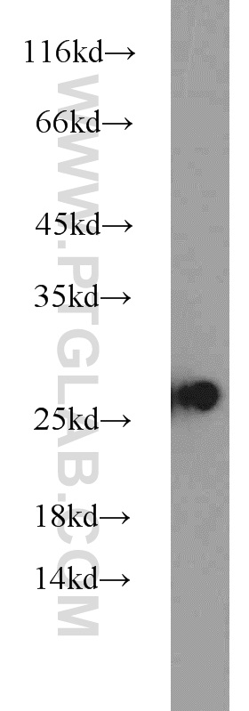 HMGB1 Polyclonal antibody