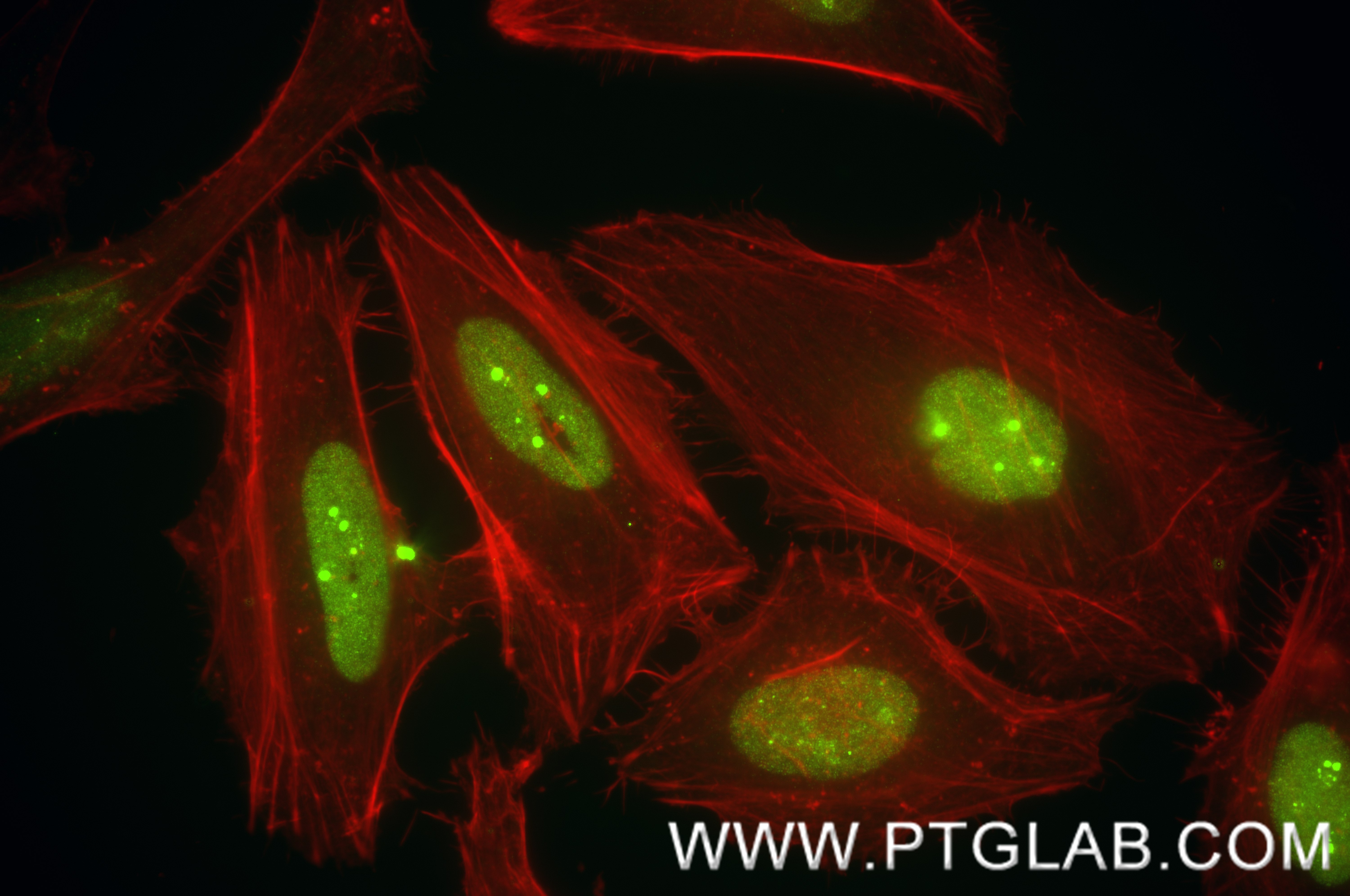 IF Staining of HeLa using 82973-1-PBS