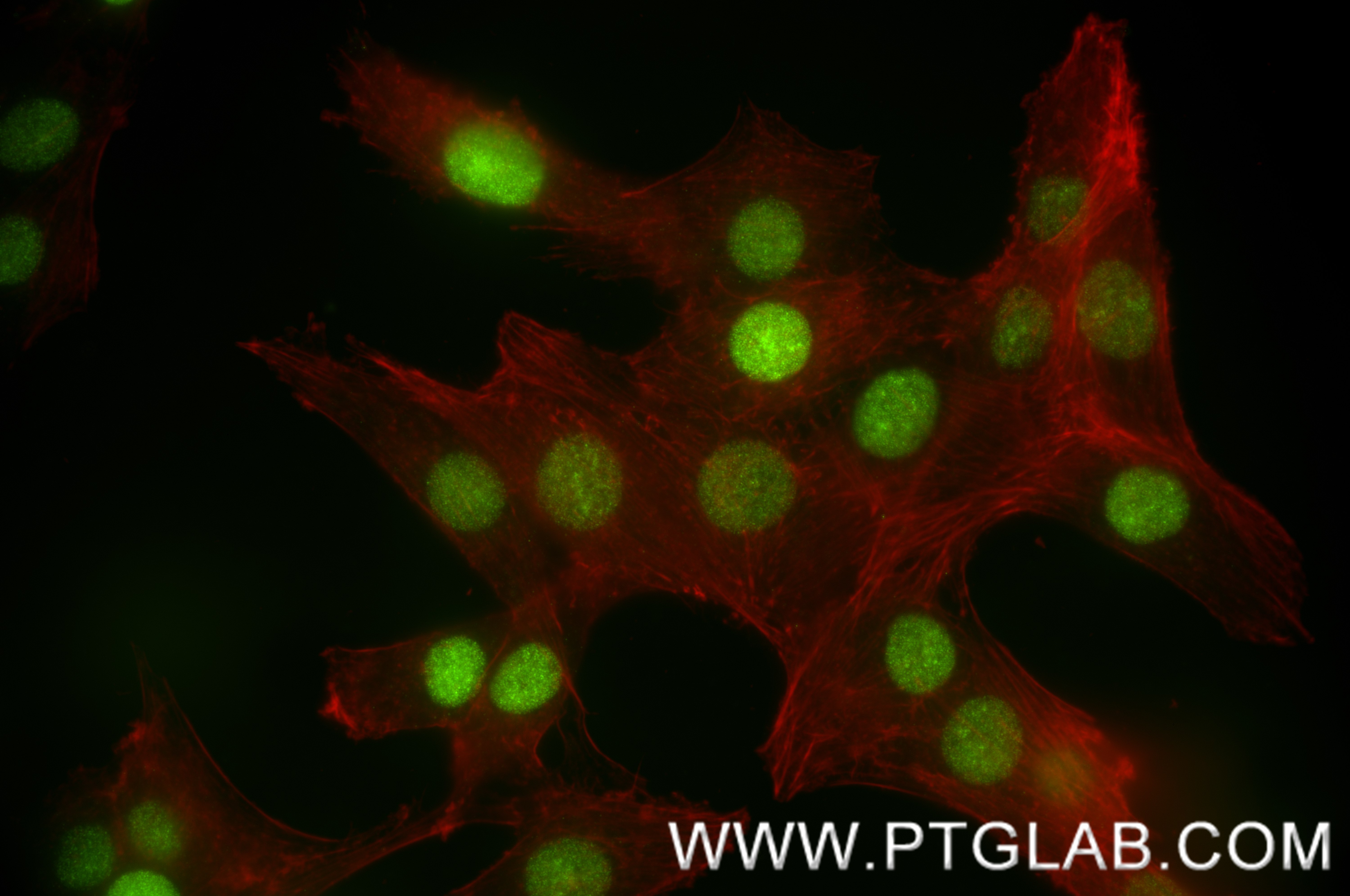 IF Staining of C6 using 82973-1-RR