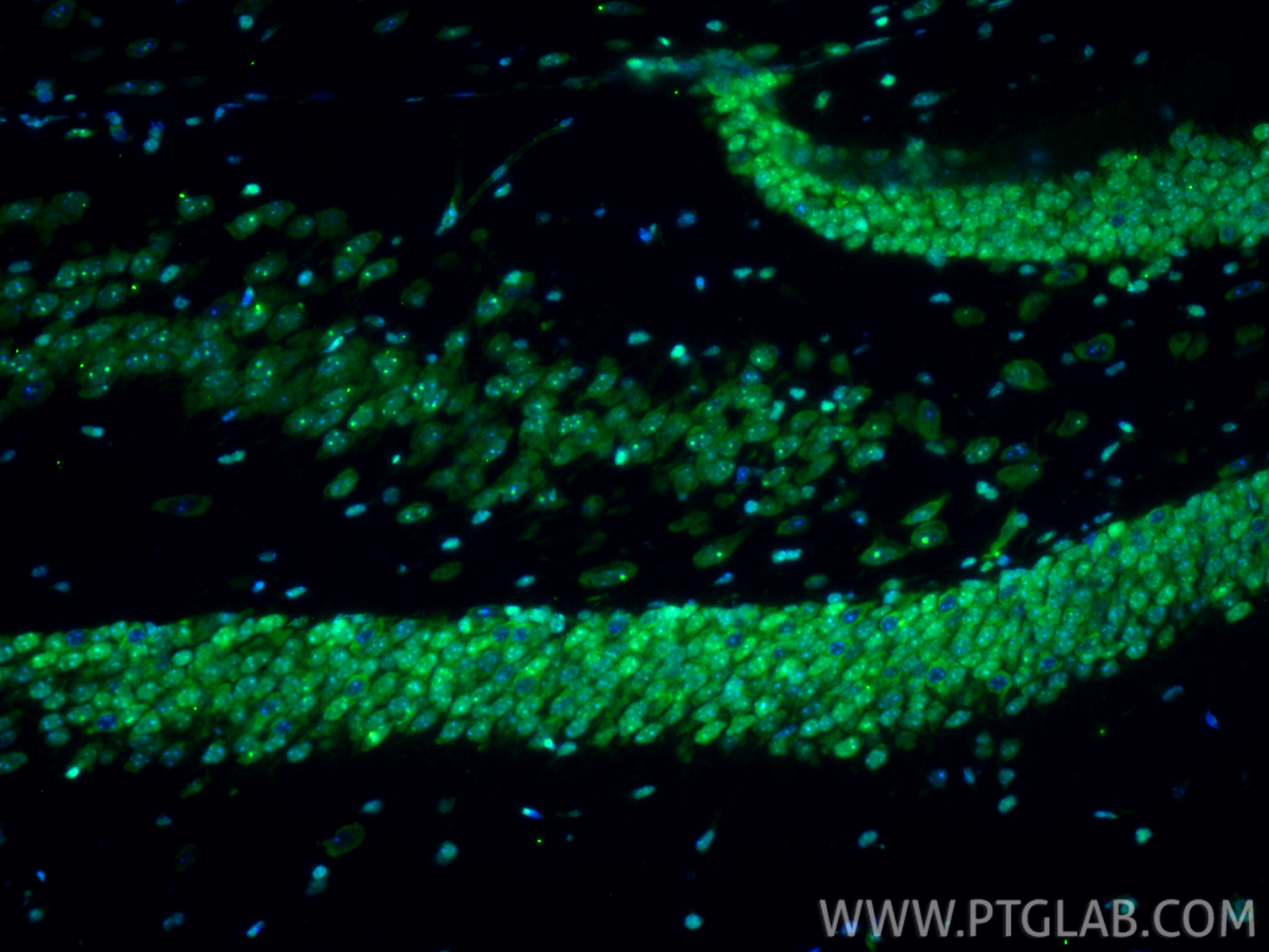 IF Staining of mouse brain using 82973-1-RR (same clone as 82973-1-PBS)