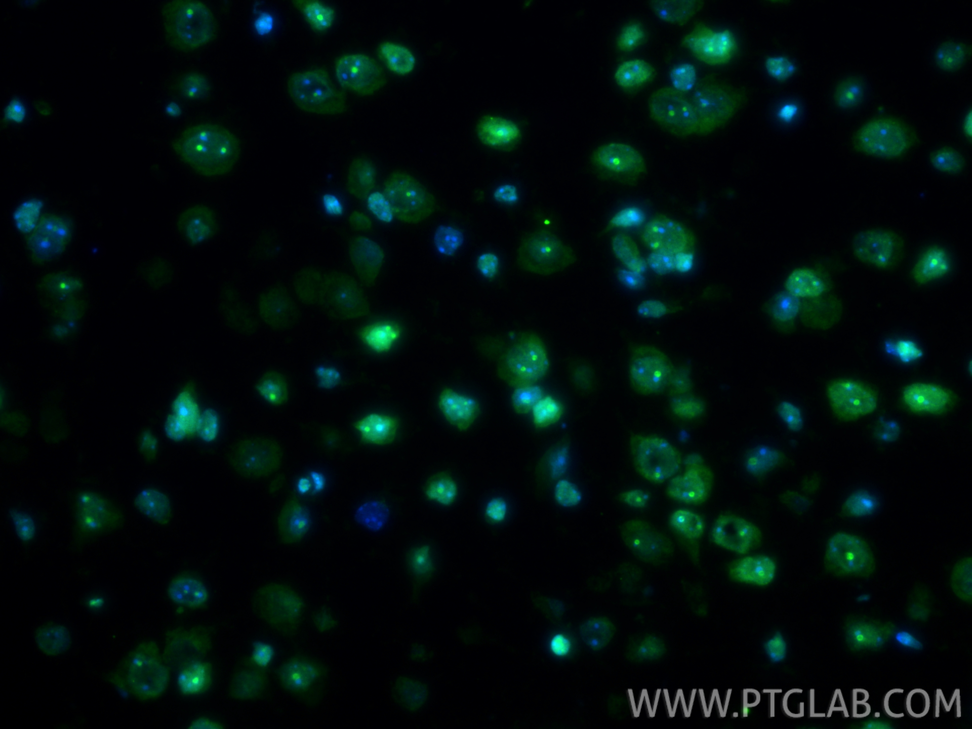 IF Staining of mouse brain using 82973-1-RR (same clone as 82973-1-PBS)