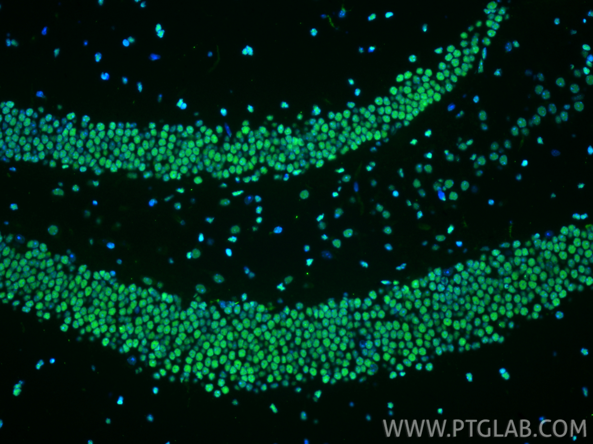 IF Staining of mouse brain using 82973-1-RR (same clone as 82973-1-PBS)