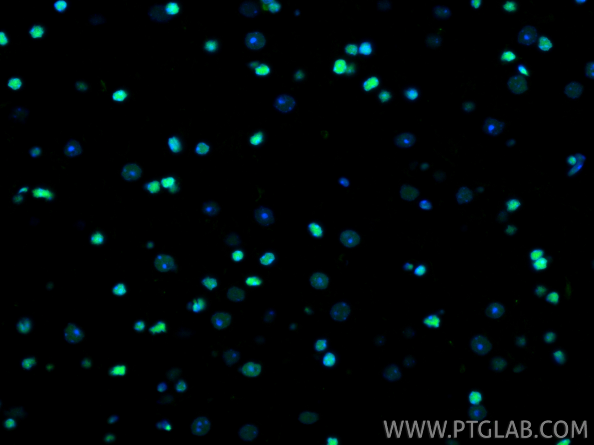 IF Staining of mouse brain using 82973-1-RR (same clone as 82973-1-PBS)