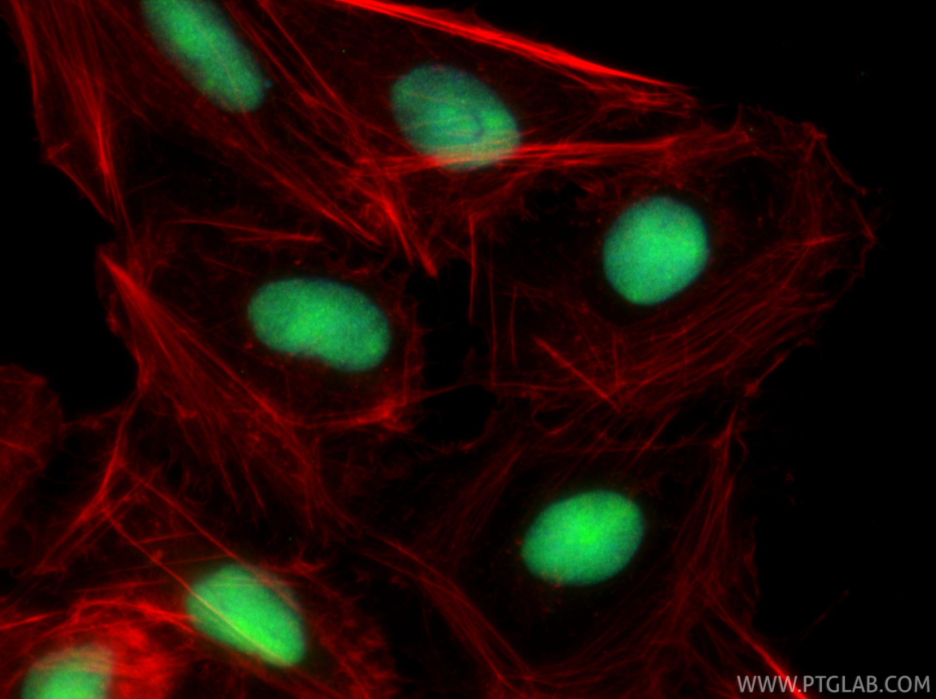 IF Staining of U2OS using 82973-1-RR