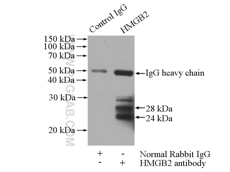 IP experiment of HEK-293 using 14597-1-AP