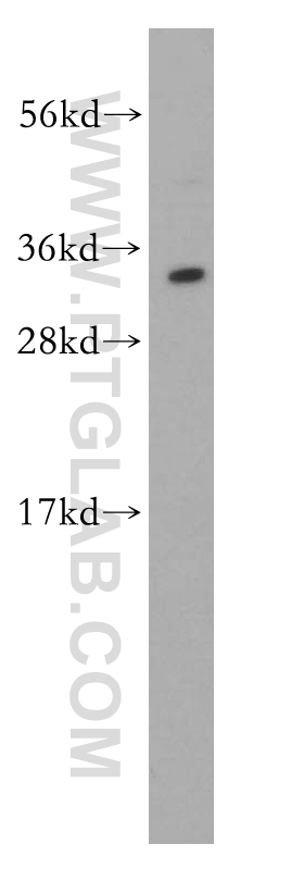 HMGB2 Polyclonal antibody