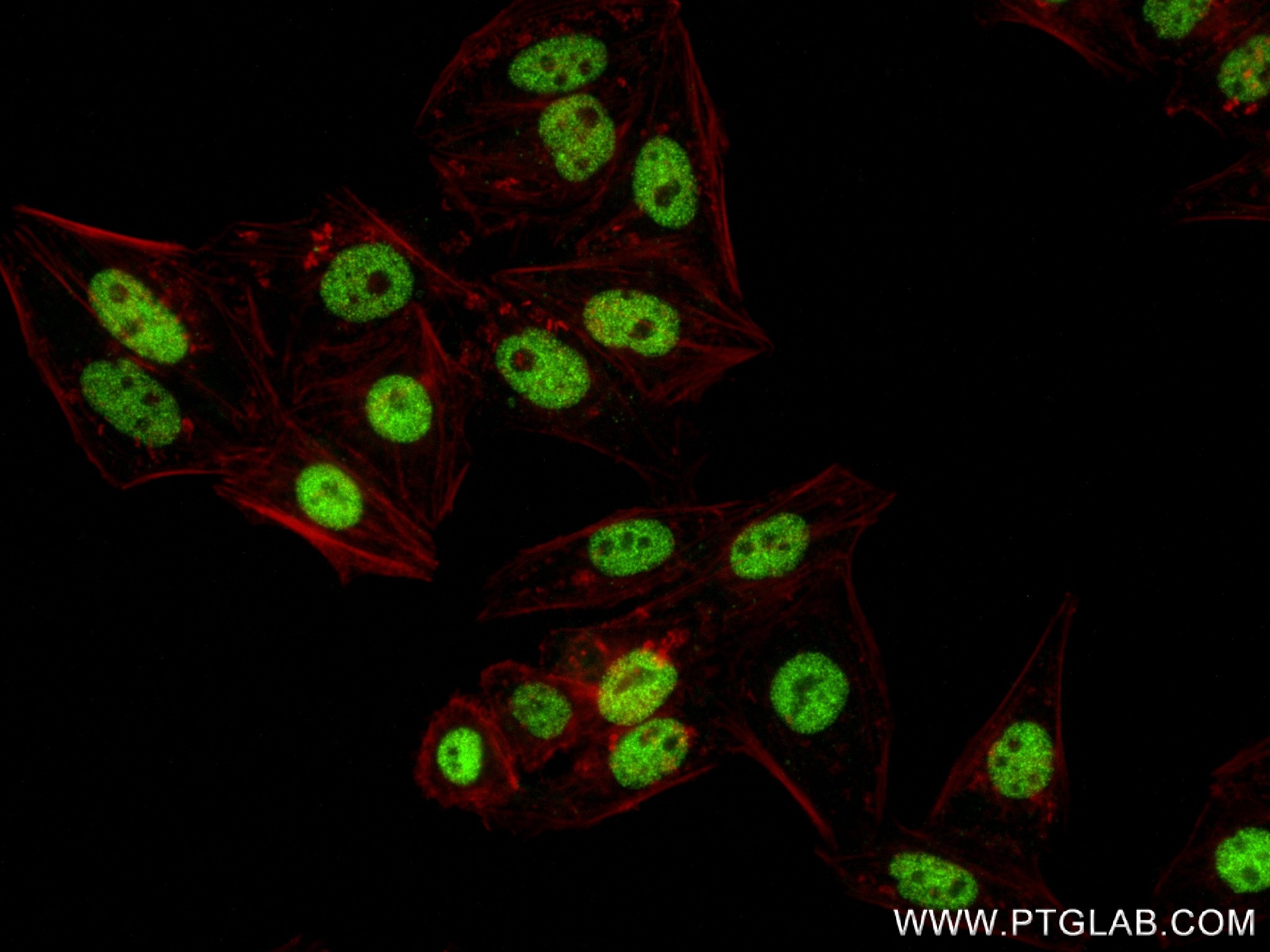 IF Staining of HepG2 using 83482-5-RR (same clone as 83482-5-PBS)