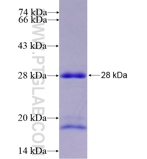 HMGB2 fusion protein Ag8110 SDS-PAGE HMGB2 fusion protein Ag8110 SDS-PAGE
