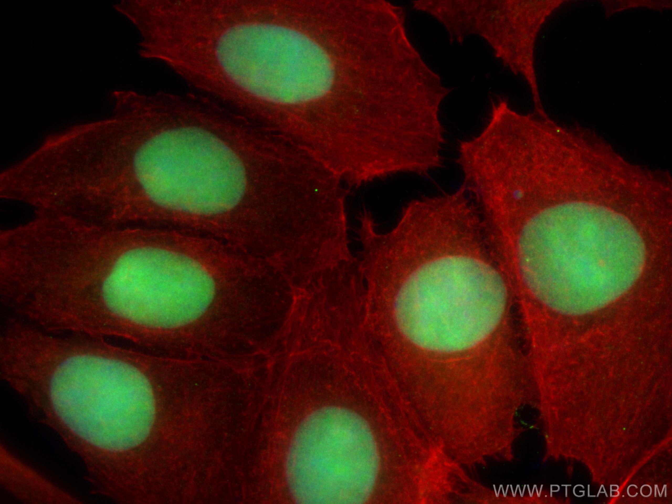 IF Staining of MCF-7 using 27465-1-AP