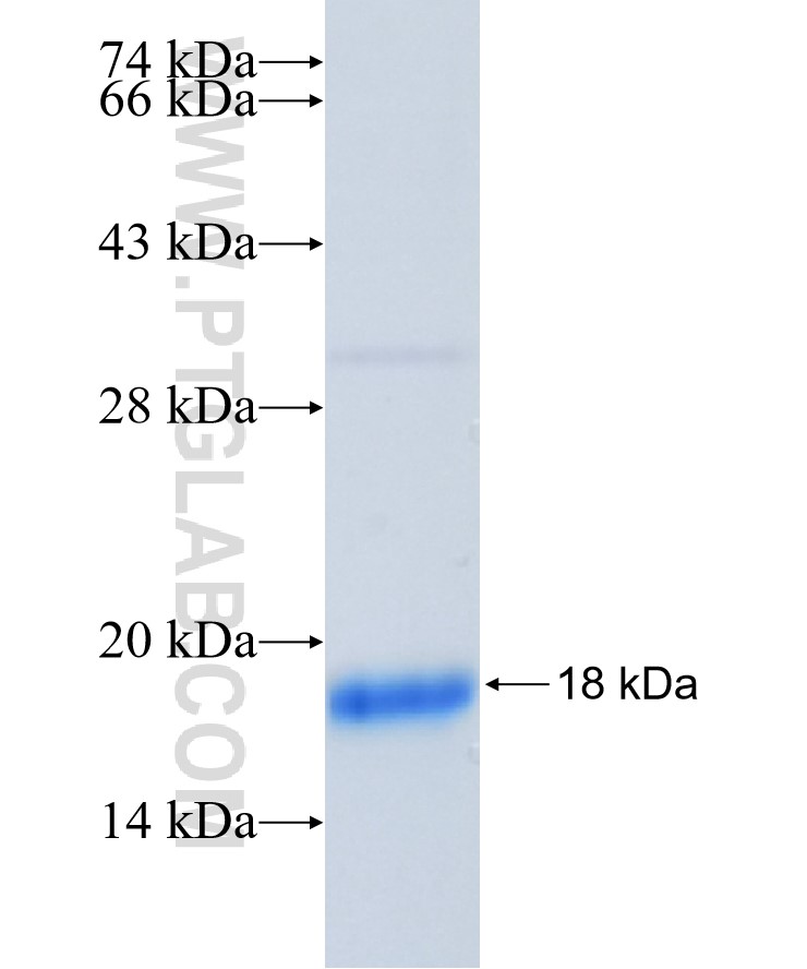 HMGB3 fusion protein Ag26376 SDS-PAGE HMGB3 fusion protein Ag26376 SDS-PAGE