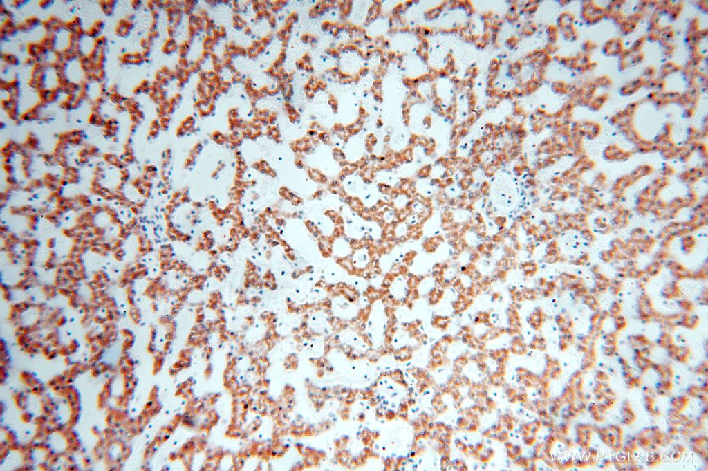 IHC staining of human liver using 16898-1-AP