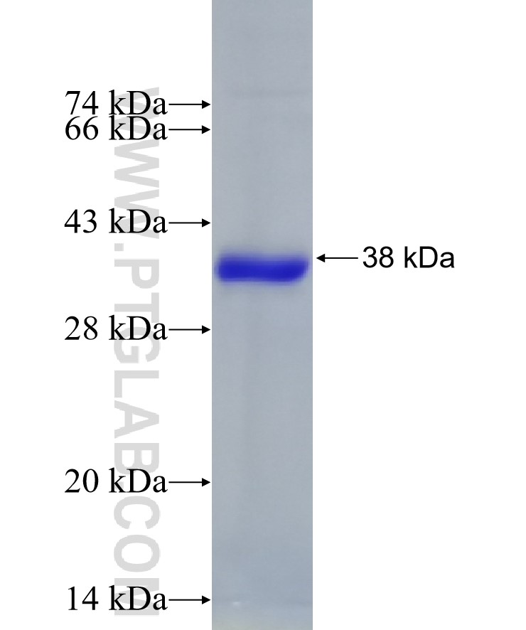 HMGCL fusion protein Ag10454 SDS-PAGE