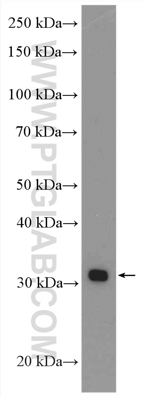 WB analysis of SKOV-3 using 17206-1-AP