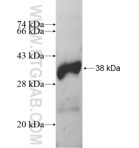 HMGCLL1 fusion protein Ag11541 SDS-PAGE