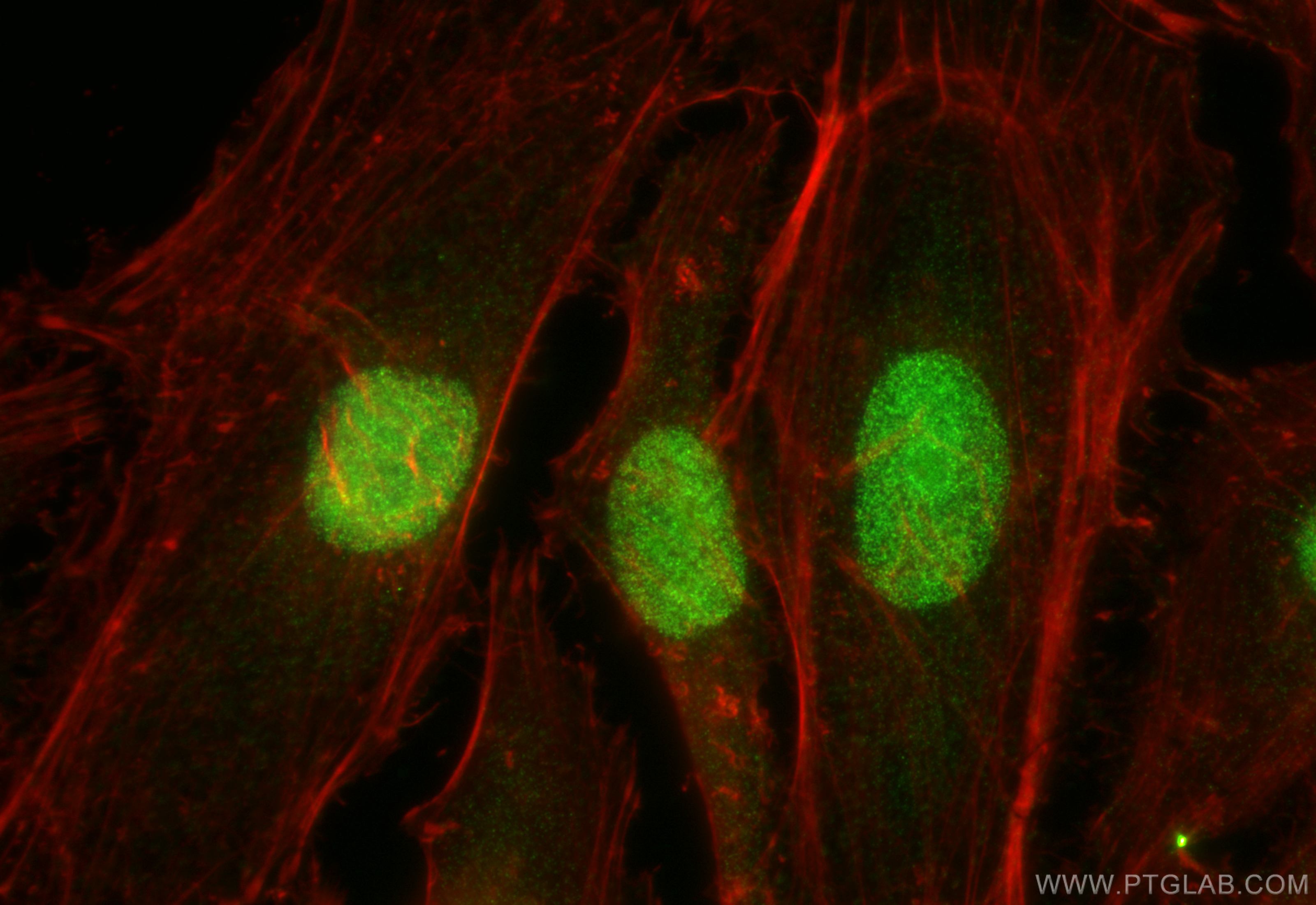 IF Staining of HeLa using 11686-1-AP