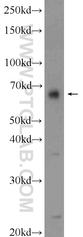WB analysis of HeLa using 24821-1-AP