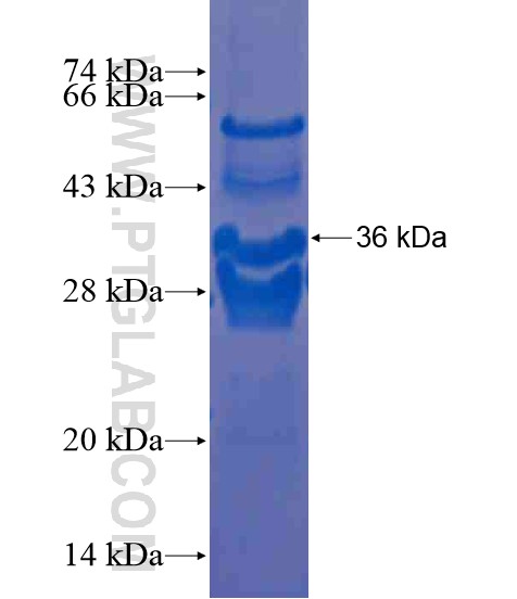 HMGXB4 fusion protein Ag20435 SDS-PAGE HMGXB4 fusion protein Ag20435 SDS-PAGE