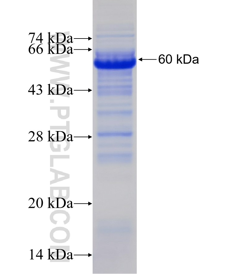 HMHA1 fusion protein Ag14480 SDS-PAGE HMHA1 fusion protein Ag14480 SDS-PAGE