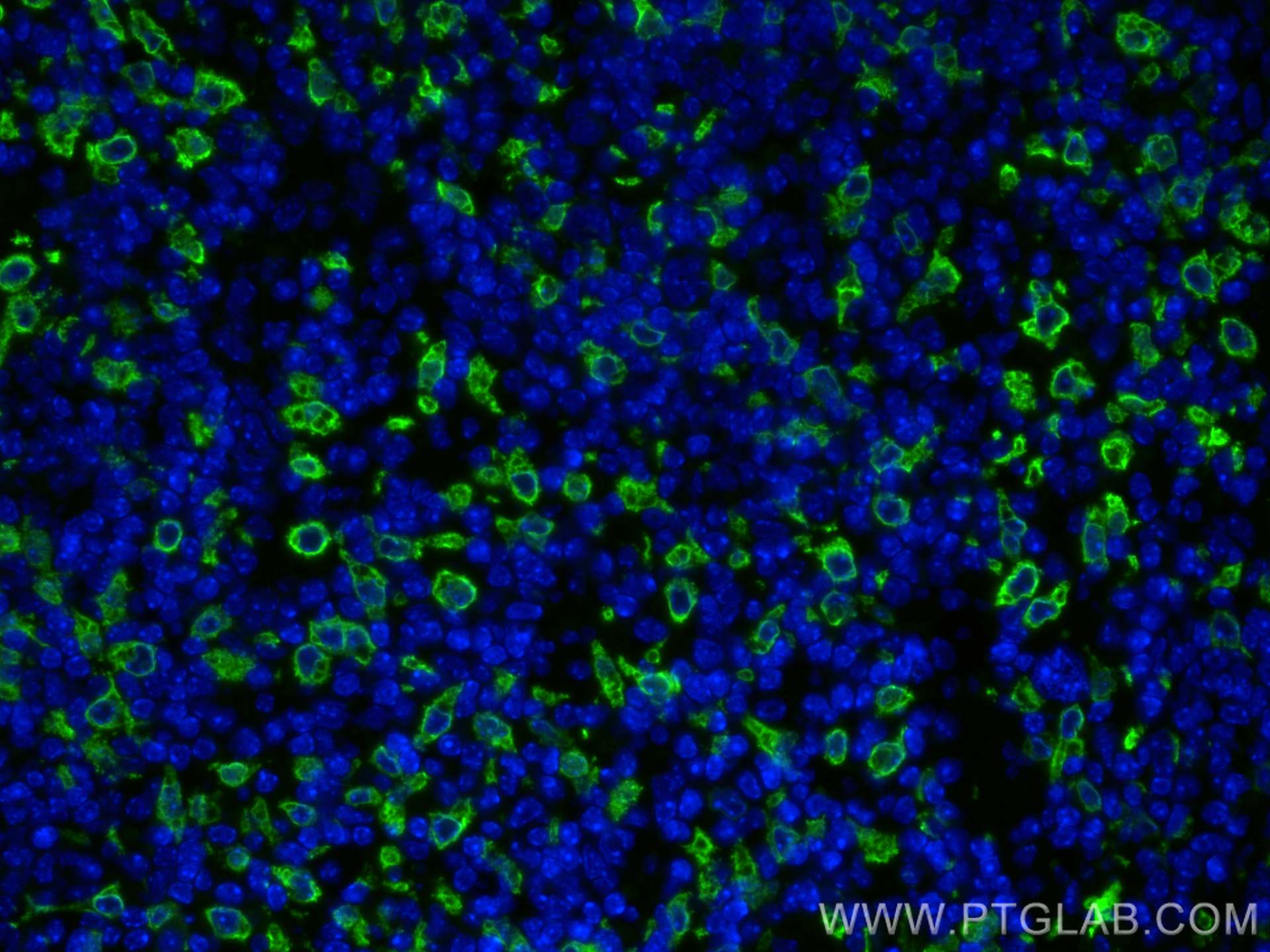 IF Staining of mouse spleen using 10701-1-AP