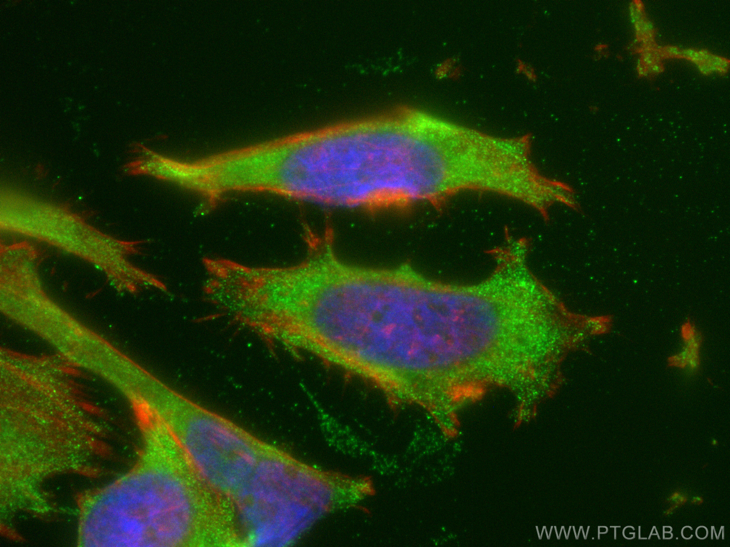 IF Staining of HeLa using 14817-1-AP