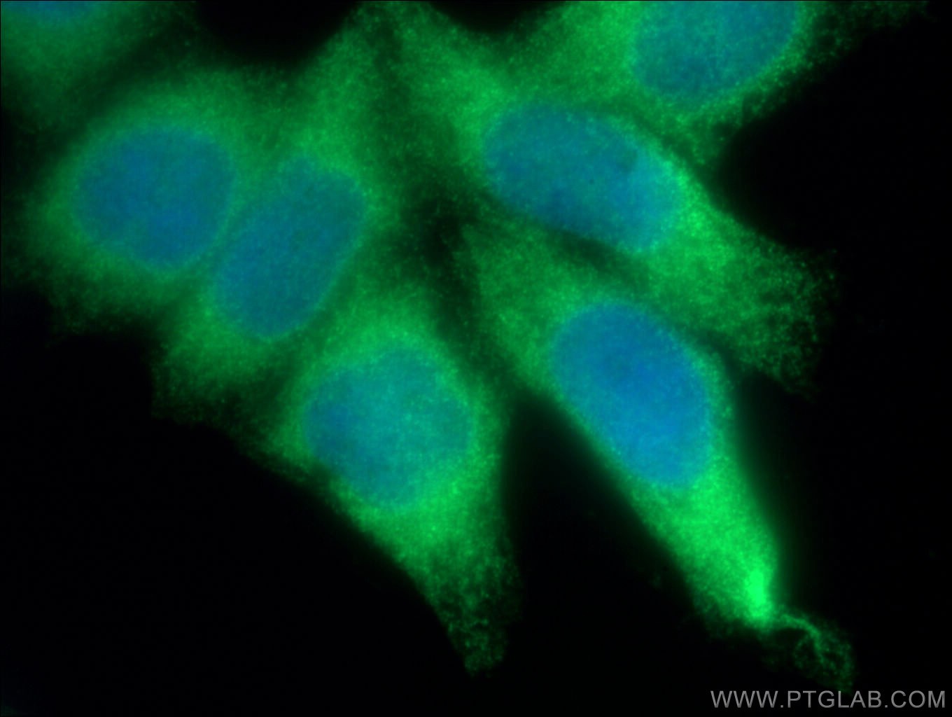 IF Staining of HeLa using 14817-1-AP